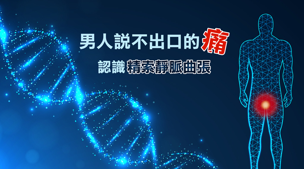 男人說不出口的痛，認識「精索靜脈曲張」