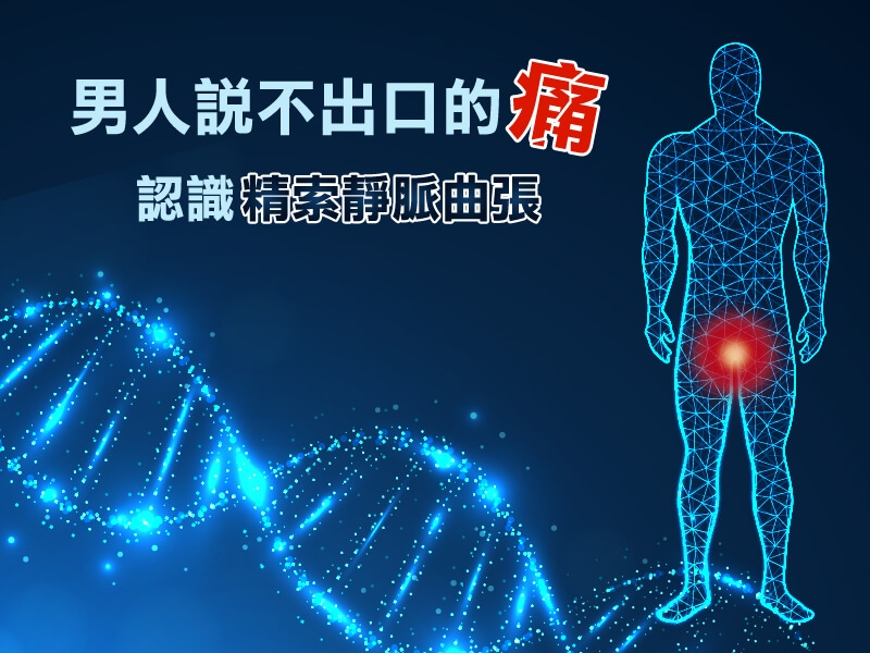 男人說不出口的痛，認識「精索靜脈曲張」