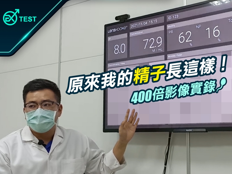 你看過自己的精子長什麼樣子嗎?醫檢師告訴你什麼是「AI影像精子分析」