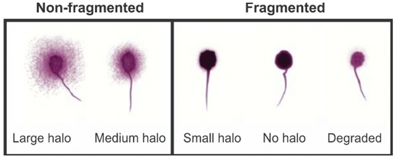 SCD - sperm chromatin dispersion