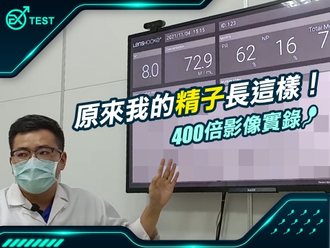 你看過自己的精子長什麼樣子嗎? 醫檢師告訴你什麼是AI影像精子分析
